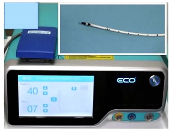 Microwave Ablation Procedure