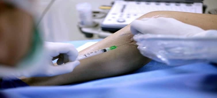 Liquid Sclerotherapy Treatment