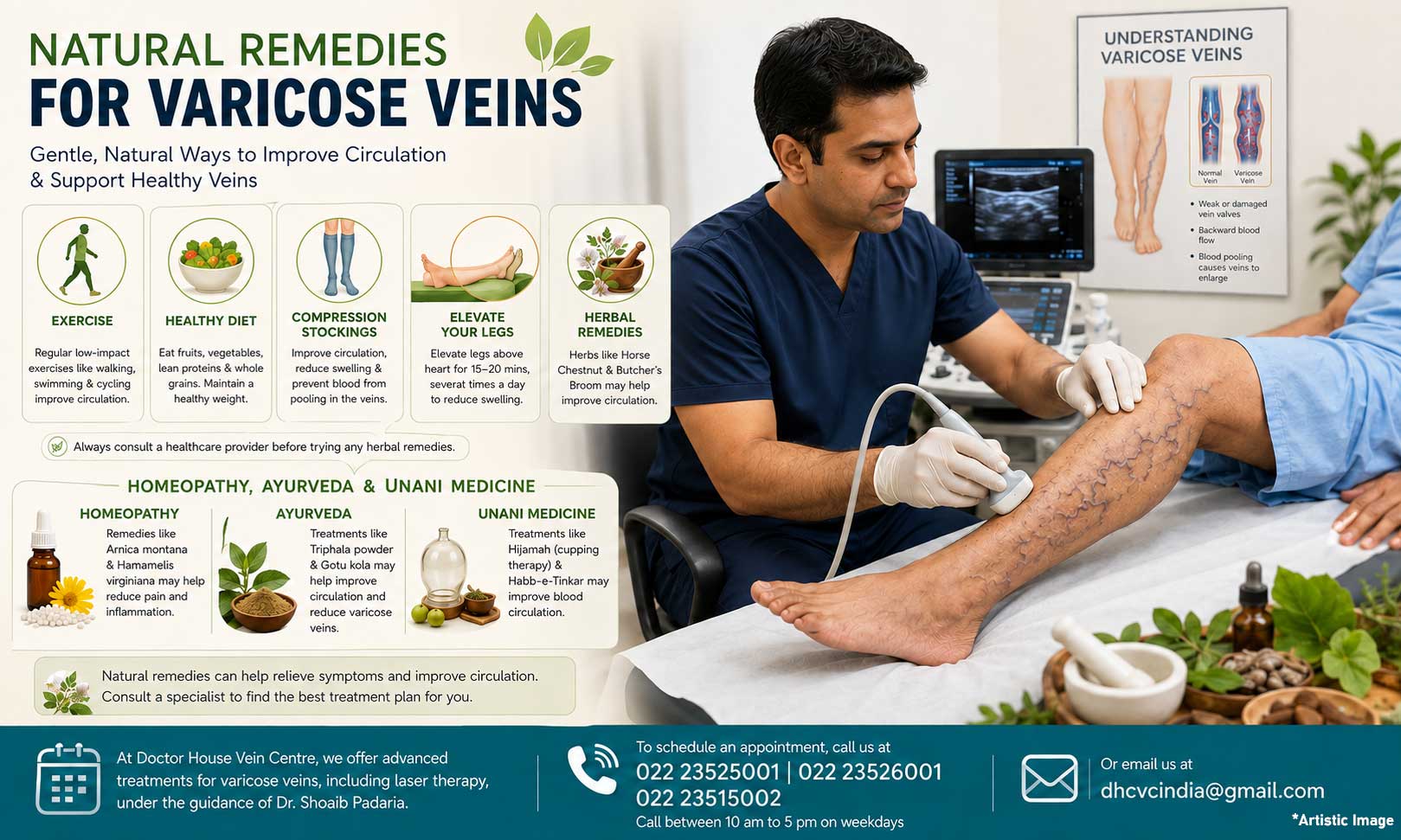 Natural Remedies for Varicose Veins: Home Remedies and DIY Treatments